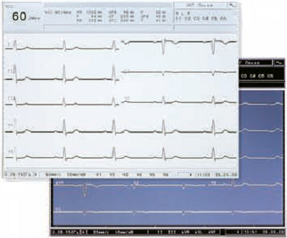 Купить электрокардиограф CARDIOVIT AT-10 plus у компании МТ Техника