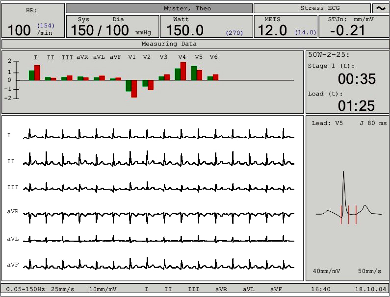 Купить электрокардиограф CARDIOVIT AT-10 plus у компании МТ Техника