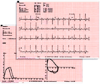 Купить 6/12 - канальный электрокардиограф CARDIOVIT AT-102  у компании МТ Техника