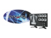 PACS-система SYNAPSE