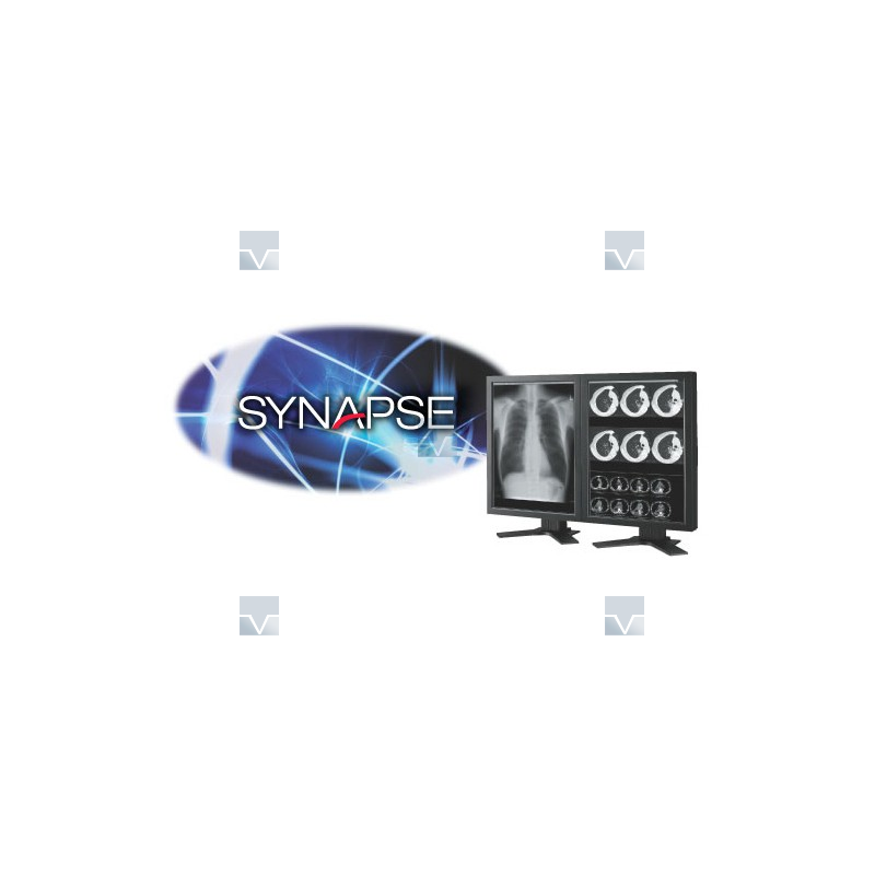Fujifilm PACS-система SYNAPSE