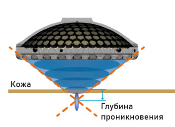 Глубина проникновения сфокусированной ударной волны