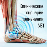 Клинические сценарии применения УВТ